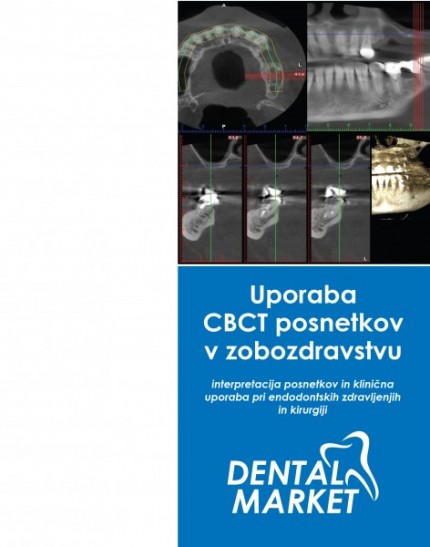 27. 5. 2016 - Uporaba CBCT posnetkov v zobozdravstvu - interpretacija posnetkov in klinična uporaba pri endodontskih zdravljenjih in kirurgiji