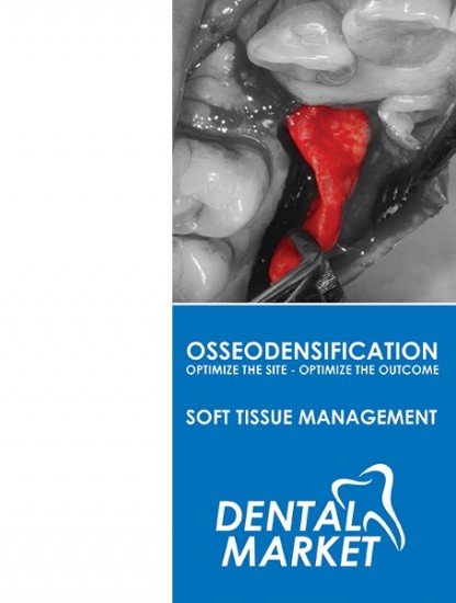 16. 3. and 17. 3. 2018  - OSSEODENSIFICATION, SOFT TISSUE MANAGEMENT